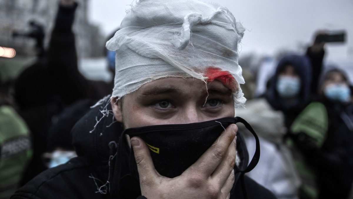 A person in a crowd holds a cloth mask to their face with a distressed expression and a large bandage wrapped on their head, with blood visible from above one eyebrow.